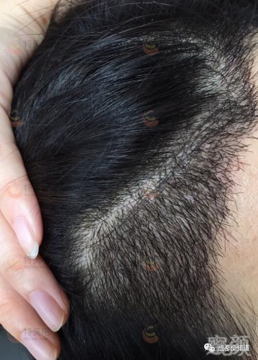 r痂$心?的简单介绍 r痂$心?的简单介绍